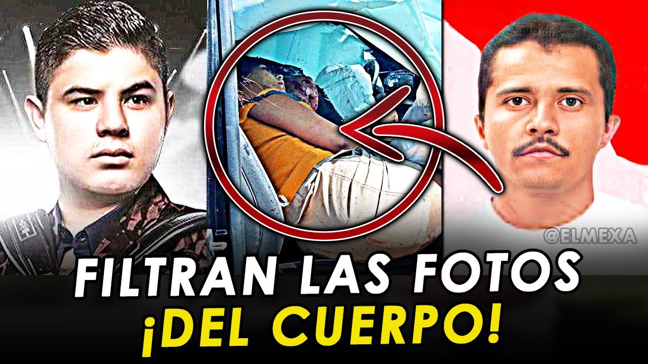 ¡FILTRAN FOTOS! Así quedo el hermano de Alfredo Olivas, tras atentado