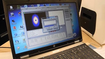 5 Lorrca deformability measurement