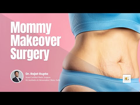 Mommy makeover – to correct post pregnacy droops, sags and