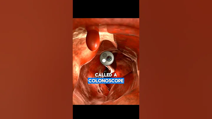 Colonoscopy | Dr. Paulien Moyaert