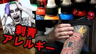 【刺青】に【アレルギー】反応！？数年前の刺青の痒み、腫れの原因が分かった。