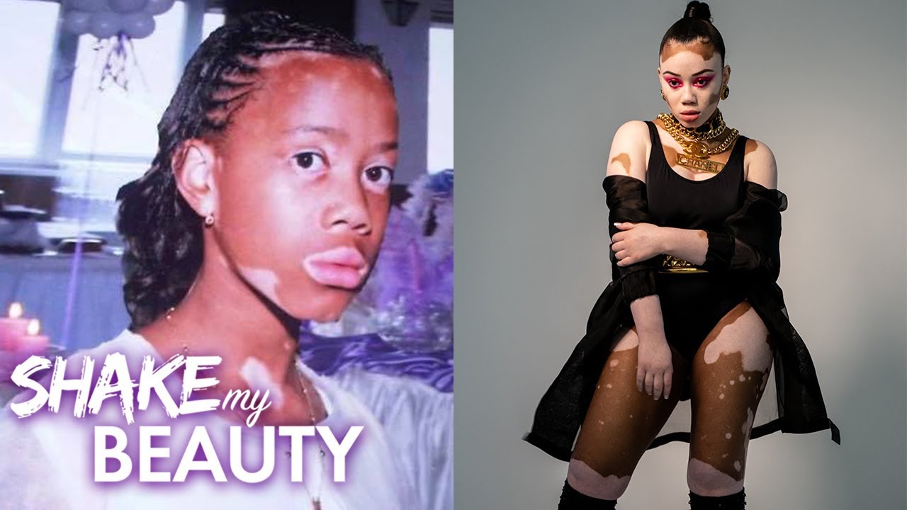 Bullies Called Me A Cow - Now I'm A Model | SHAKE MY BEAUTY