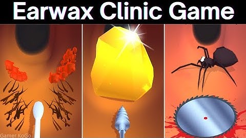 Earwax Clinic in Max Levels Android Game Walkthrough Update All Trailers,Gameplay GZLEUIY