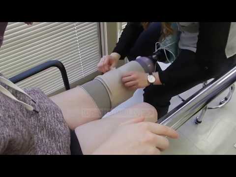 Video: Sa kushton një protezë e gjymtyrëve?