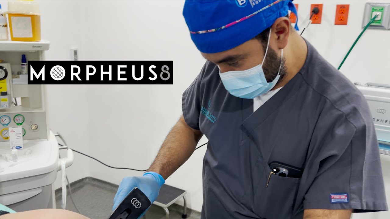 Conoce todo sobre Morpheus8, ¡Tecnología de rejuvenecimiento!