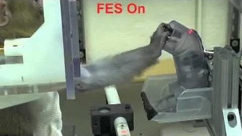 Restoration of grasp following paralysis through brain-controlled stimulation of muscles (Movie 1)