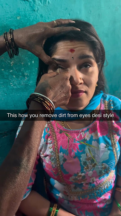 Removing dirt from eyes 😱😰 #viral #viralvideo #viralshorts #bodyhacks