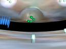 Medical animation of nerve synapse