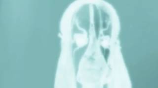 Sicknote - Benefit Cheat
