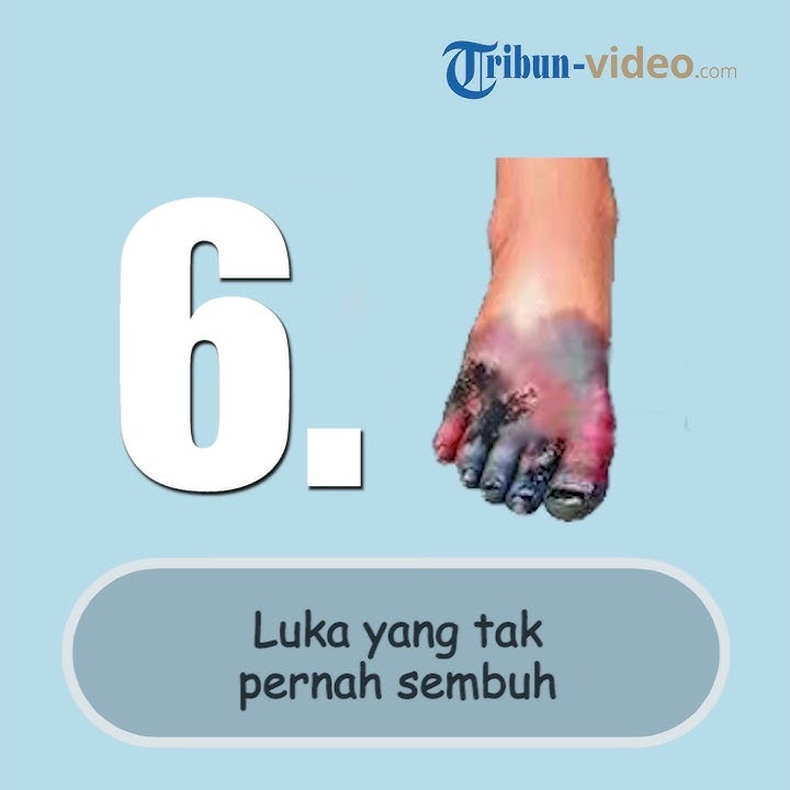 Hari Diabetes Sedunia - Yuk Kenali 6 Gejala Diabetes!