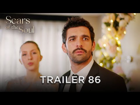 Scars Of The Soul Trailer 86 Alaca English Subtitles