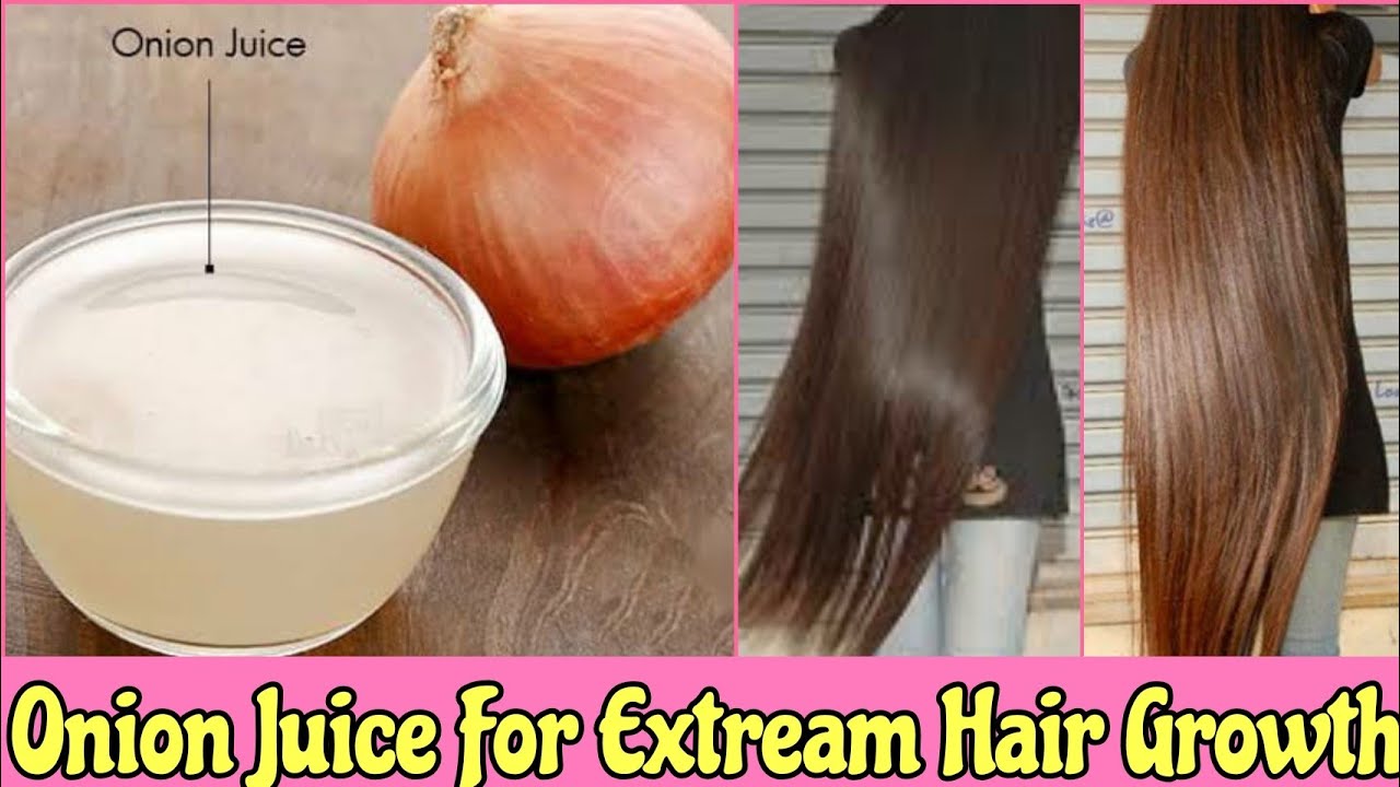 How To Use Onion Juice For Hair Regrowth, Dandruff And Hair fall