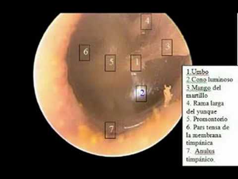 Ear Anatomy - YouTube