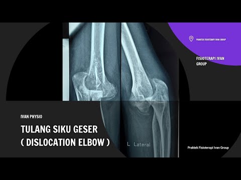 Postoperative elbow / elbow dislocation exercise