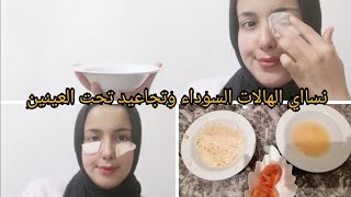 طريقة التخلص سريعا من الهالات السوداء طبيعيا | وداعا وداعا الدوائر السوداء