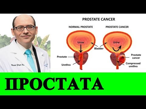 Video: Kurkuma I Rak Prostate: Djeluje Li?