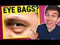 Eye Doctor Explains How to Get Rid of Under EYE BAGS