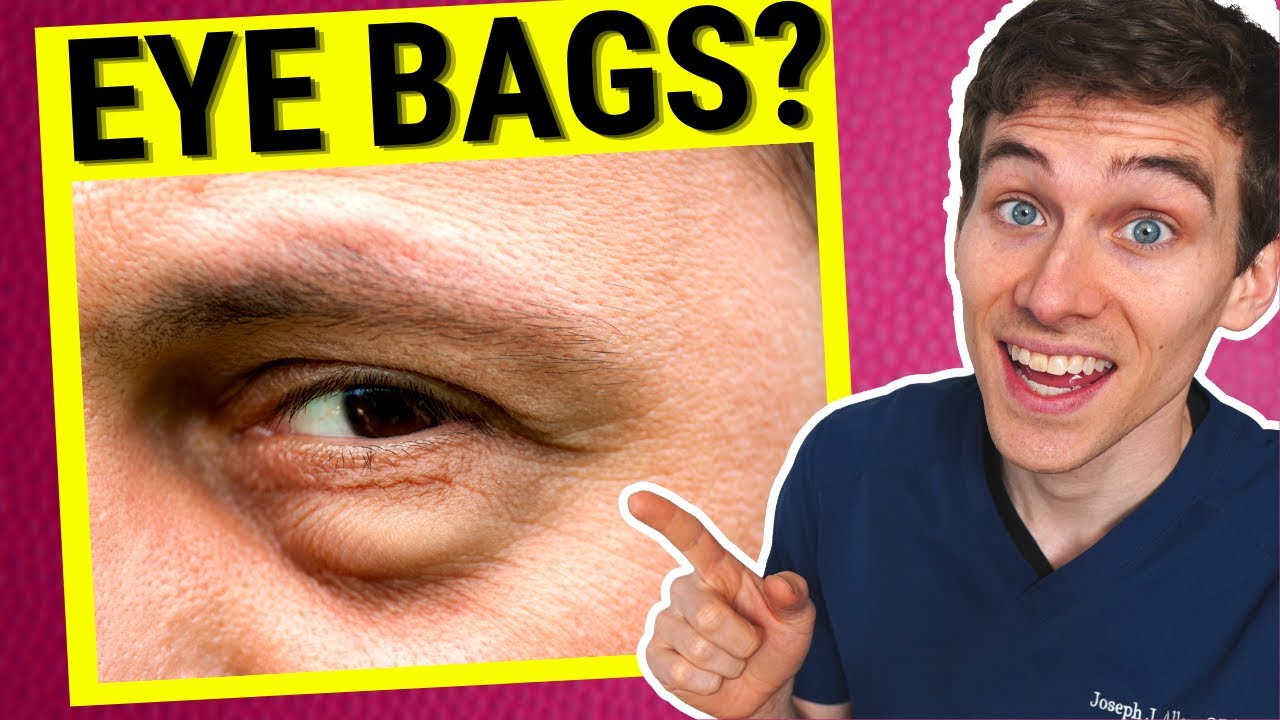 Eye Doctor Explains How to Get Rid of Under EYE BAGS 