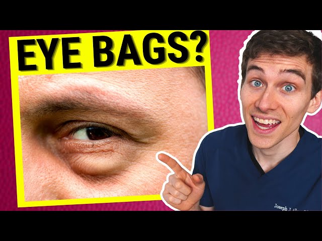 Male Eye Bags: 5 Common Causes & How to Get Rid of Them – PrettyBoy