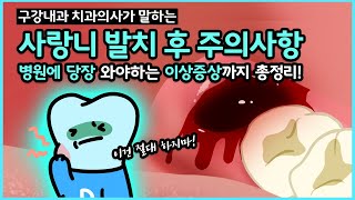 Wisdom Tooth Extraction Recovery Tips (Extraction Aftercare with Tooth Extraction Animation)