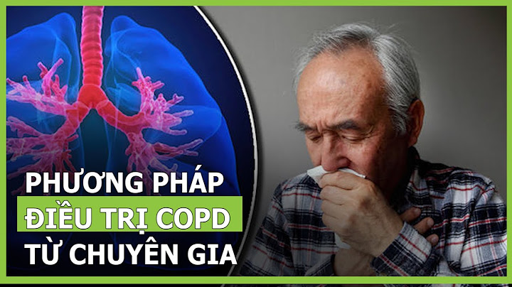 Phương pháp điều trị tự kỷ chính là gì