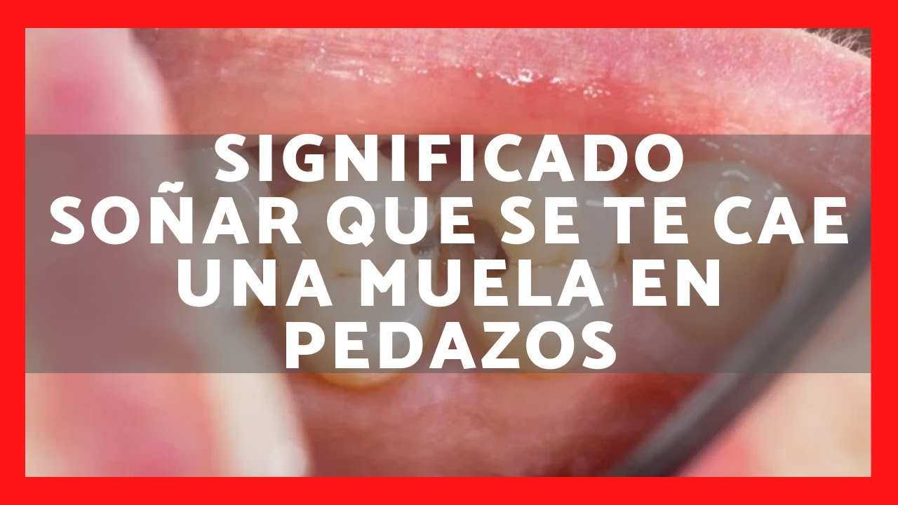 ️QUÉ SIGNIFICA SOÑAR QUE SE TE CAE UNA MUELA EN PEDAZOS 2023 SIGNIFICADO SUEÑO QUE TE CAE UN ️QUÉ SIGNIFICA SOÑAR QUE SE TE CAE UNA MUELA EN PEDAZOS 2023 SIGNIFICADO SUEÑO QUE TE CAE UN
