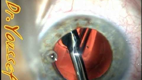 Kinked Trailing haptic