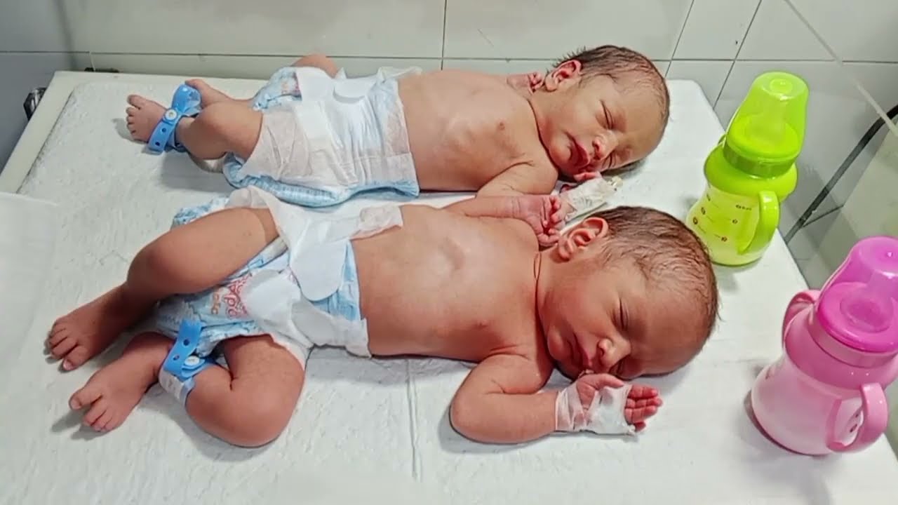 Cute Preterm Twin Babies in NICU | Observation Care & Starting First Feeding Trial