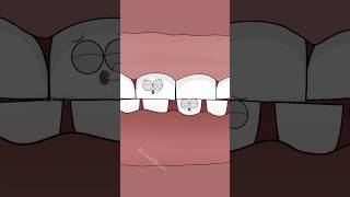 Why He Grinds His Teeth Every Night