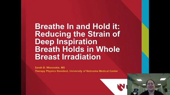 VIDEO ABSTRACT:Using FFF free beams in ECOMP whole breast irradiation w/deep inspiration breath hold