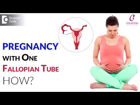 Does Having Only One Fallopian Tube Cause Infertility