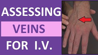 Assessing Veins When Starting an IV Catheter | Finding Veins & Tourniquet Nursing Skill