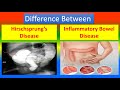 Difference Between Hirschsprung’s Disease and Inflammatory Bowel Disease