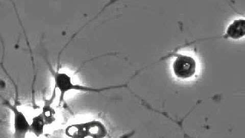 Neurite outgrowth
