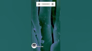 #interview #macro #micro #zoom #inter #shortvideo #microscope #zooming