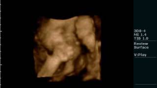 09 05 14 175854 BABY MUIRHEAD 20090514 175854 0038