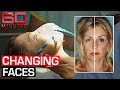 'Psychiatry with knives': Can cosmetic surgery really make you happier? | 60 Minutes Australia