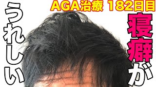 薄毛になったら寝癖はつかない Aga治療してからの寝癖がうれしい Youtube