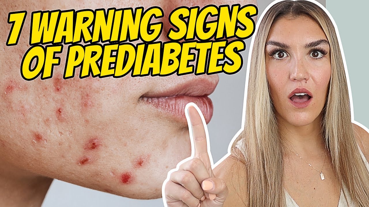 7 Early Warning Signs of Prediabetes You Can't Ignore! YouTube