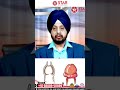Paraphimosis Kya Hai In Hindi Treatment Ilaj Penis Foreskin Peechay Atak Jaye To Kya Karein Paraphimosis Kya Hai In Hindi Treatment Ilaj Penis Foreskin Peechay Atak Jaye To Kya Karein