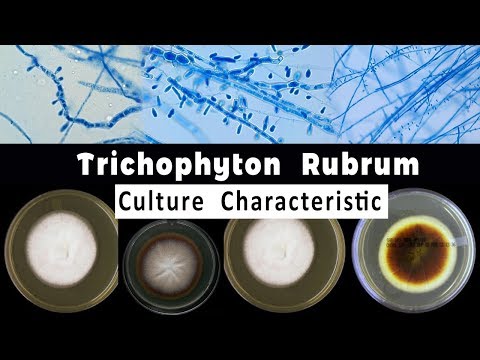 Video: Waar wordt trichophyton rubrum gevonden?