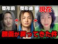 整形した顔が元に戻ってきた件について【Repezen Foxx｜レペゼンフォックス 】
