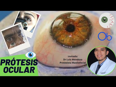 Vídeo: Ojo Protésico: Costo, Cuidado, Cirugía Y Más