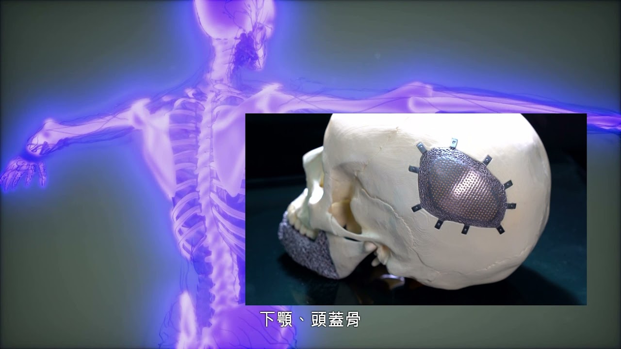 促進組織整合仿生3d列印技術 Youtube