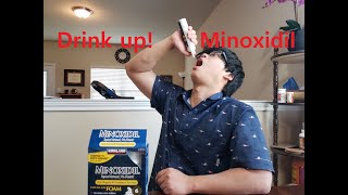 Minoxidil Beard Asian (Week 0)