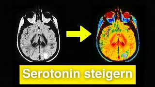 Die Wahrheit: So erhöhst du dein Serotonin natürlich (30 Tage)