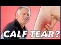 Calf Tear, Strain, or Pain? Absolute Best Self Treatment and Exercises.