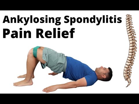 Video: Rawatan Ankylosing Spondylitis: Dadah, Senaman Dan Banyak Lagi