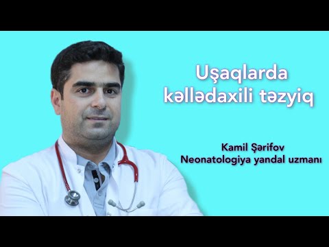 Video: Endometrioz və hamiləlik: konsepsiya ehtimalı, fəsadlar, rəylər