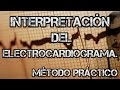 【Aprende a interpretar un electrocardiograma】Rápido, fácil y sencillo!